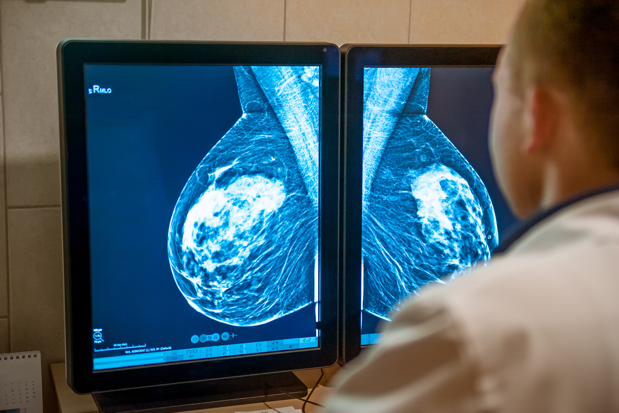 Mammogram Examination Selective Focus